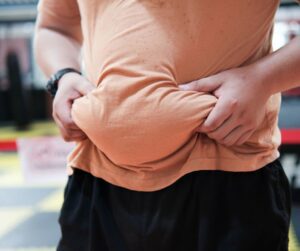Man holding abdominal body fat, representing medical weight loss and body composition management